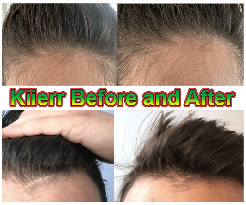 Kiierr before and after photos