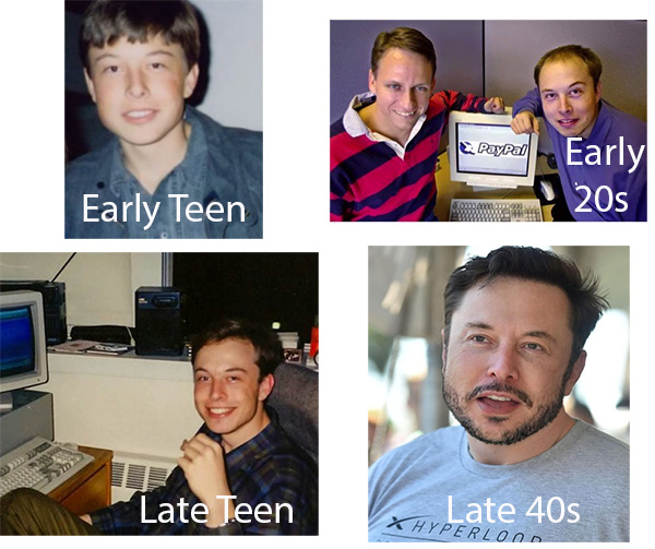 how did elon musk reversed his hair loss