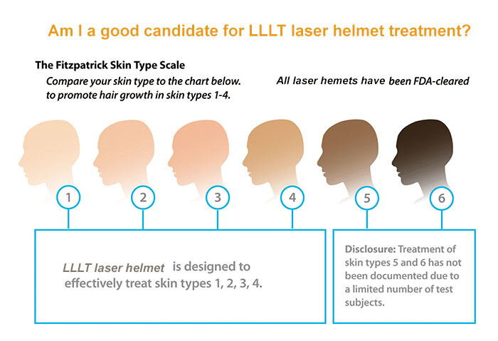 lasser helmet fitzpatrick skin type