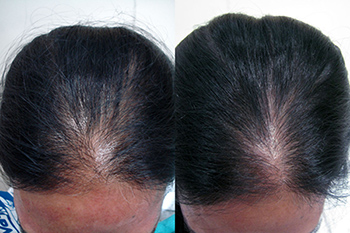 stemoxydine results