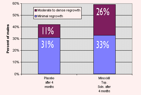 Minoxidil Frequently Asked Questions 