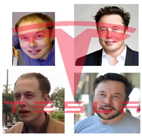 elon musk hair loss