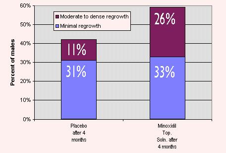 Minoxidil Frequently Asked Questions 