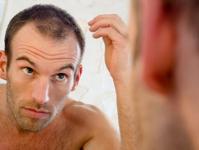 minoxidil shedding