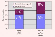 Minoxidil Frequently Asked Questions 
